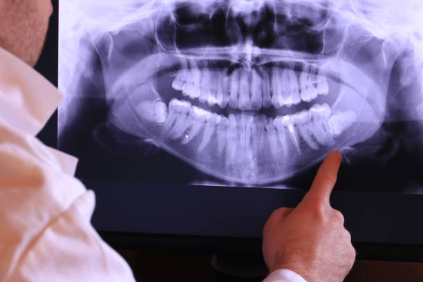 Best Emergency Treatment for Toothache in Throop, PA