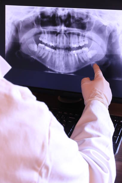 Best Emergency Tooth Extraction in Throop, PA