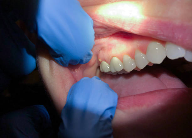 Best Pediatric Emergency Dentist in Throop, PA